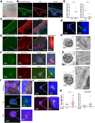 Dendritic cell proliferation by primary cilium in atopic dermatitis